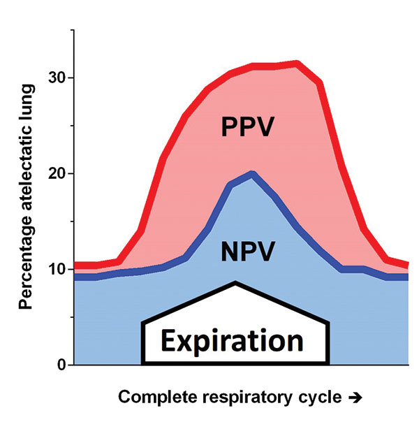 Percentage of atelectatic lung during positive and negative pressure ventilation in surfactant depleted rabbits, adapted from reference